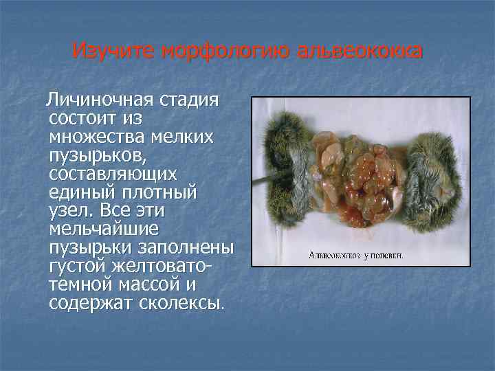 Изучите морфологию альвеококка Личиночная стадия состоит из множества мелких пузырьков, составляющих единый плотный узел.