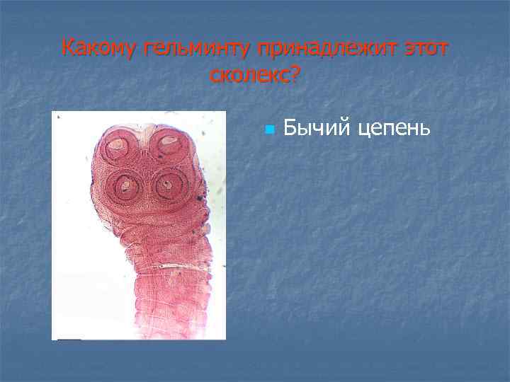 Какому гельминту принадлежит этот сколекс? n Бычий цепень 