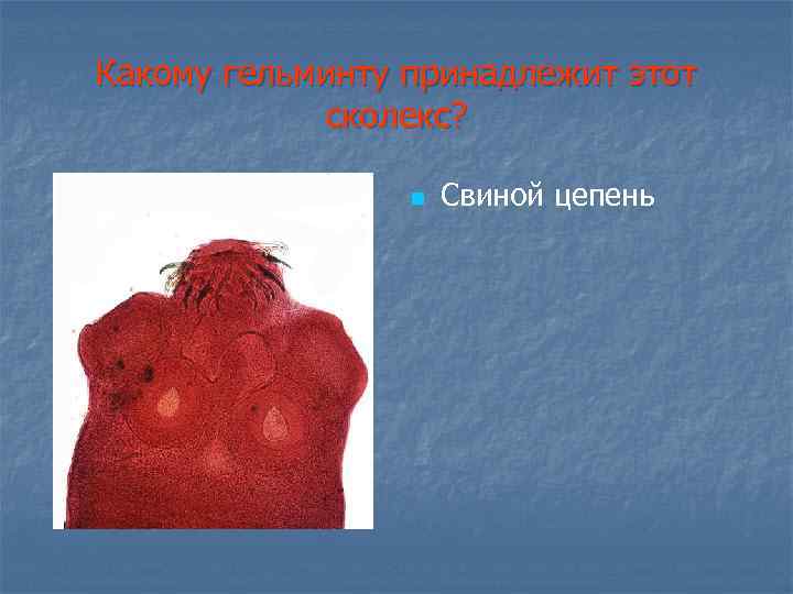 Какому гельминту принадлежит этот сколекс? n Свиной цепень 