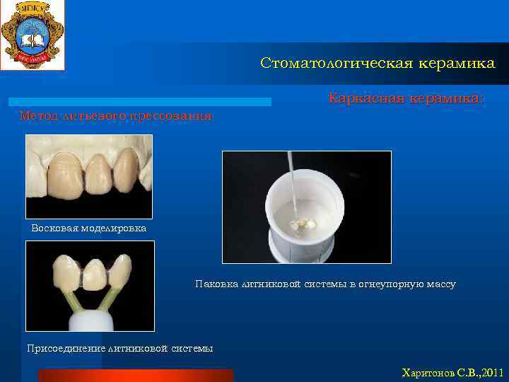 Стоматологическая керамика Каркасная керамика: Метод литьевого прессования Восковая моделировка Паковка литниковой системы в огнеупорную
