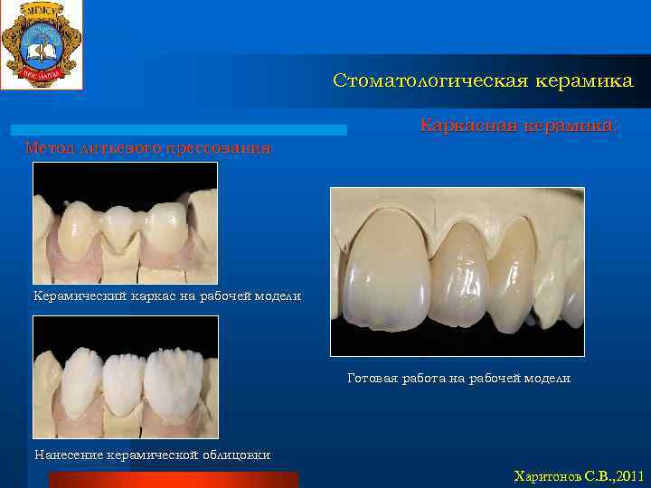 Стоматологическая керамика Каркасная керамика: Метод литьевого прессования Керамический каркас на рабочей модели Готовая работа