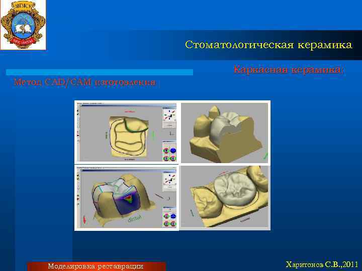 Стоматологическая керамика Каркасная керамика: Метод CAD/CAM изготовления Моделировка реставрации Харитонов С. В. , 2011
