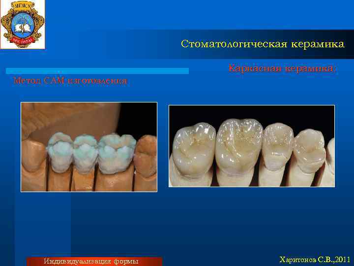 Стоматологическая керамика Каркасная керамика: Метод CAM изготовления Индивидуализация формы Харитонов С. В. , 2011