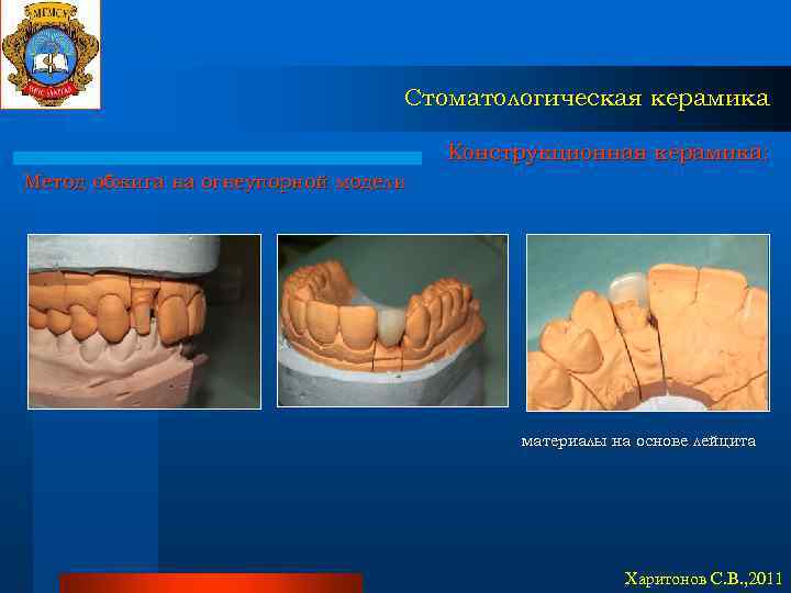Стоматологическая керамика Конструкционная керамика: Метод обжига на огнеупорной модели материалы на основе лейцита Харитонов