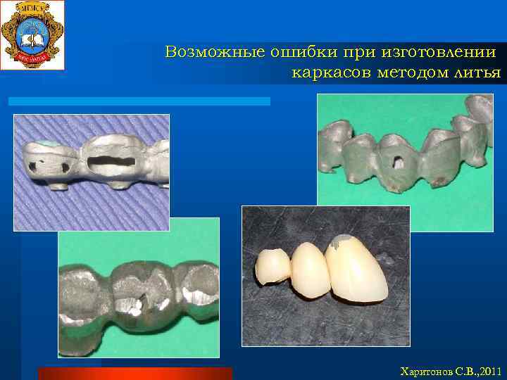 Возможные ошибки при изготовлении каркасов методом литья Харитонов С. В. , 2011 