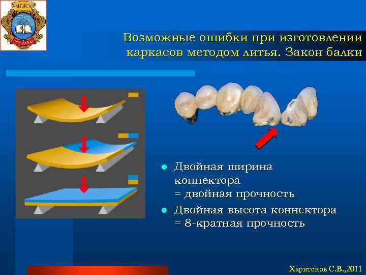 Возможные ошибки при изготовлении каркасов методом литья. Закон балки Двойная ширина коннектора = двойная