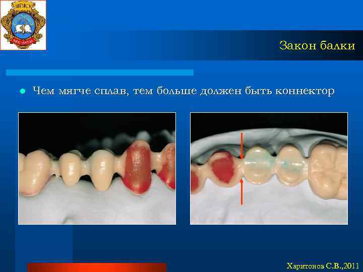 Закон балки l Чем мягче сплав, тем больше должен быть коннектор Харитонов С. В.