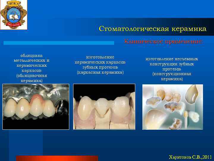 Стоматологическая керамика Клиническое применение: облицовка металлических и керамических каркасов (облицовочная керамика) изготовление керамических каркасов
