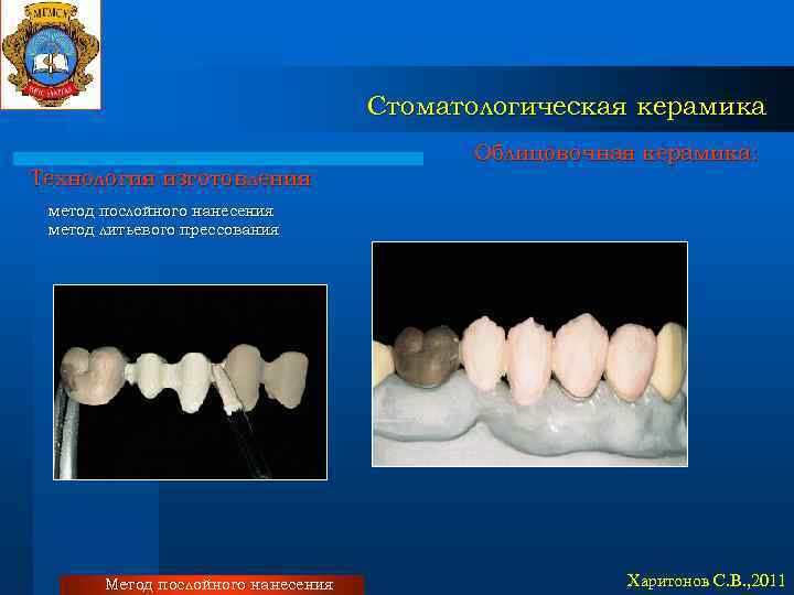Стоматологическая керамика Технология изготовления Облицовочная керамика: метод послойного нанесения метод литьевого прессования Метод послойного