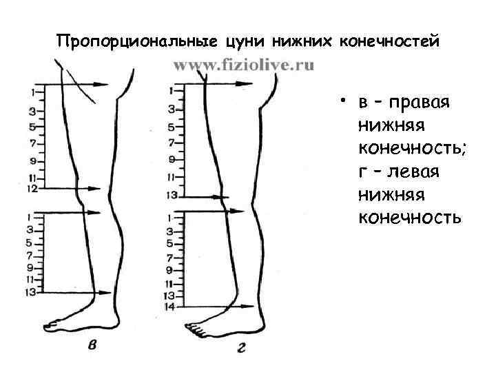 Пропорциональные цуни нижних конечностей • в – правая нижняя конечность; г – левая нижняя