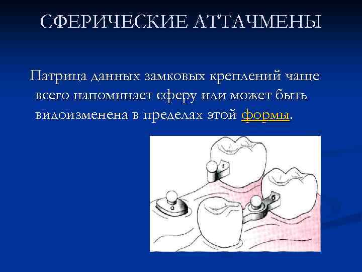 СФЕРИЧЕСКИЕ АТТАЧМЕНЫ Патрица данных замковых креплений чаще всего напоминает сферу или может быть видоизменена
