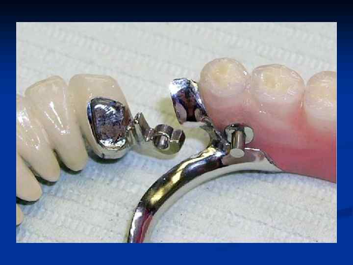 Замковые крепления 