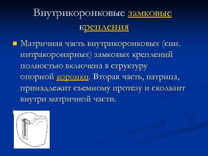 Внутрикоронковые замковые крепления n n Матричная часть внутрикоронковых (син. интракоронарных) замковых креплений полностью включена