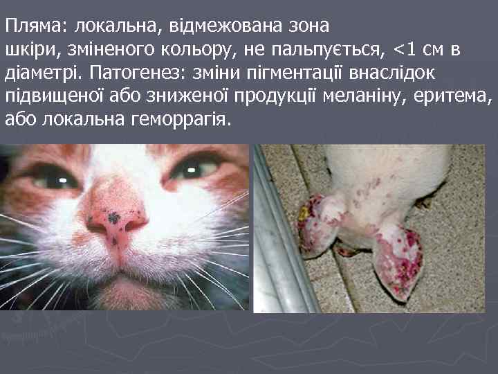 Пляма: локальна, відмежована зона шкіри, зміненого кольору, не пальпується, <1 см в діаметрі. Патогенез: