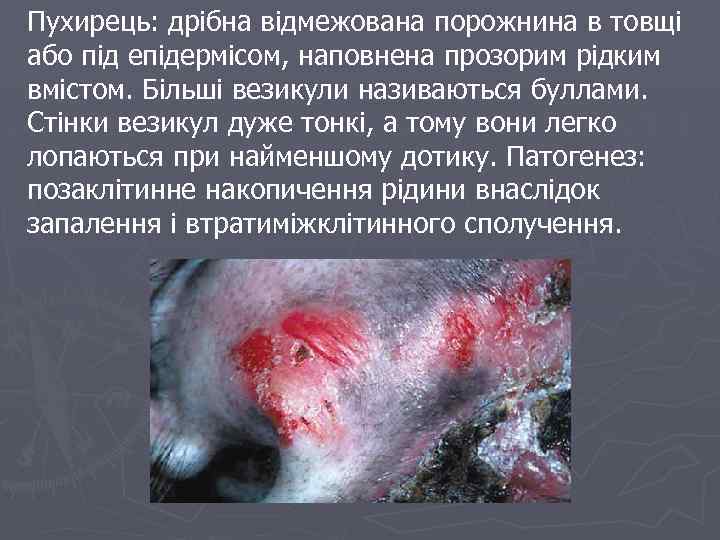 Пухирець: дрібна відмежована порожнина в товщі або під епідермісом, наповнена прозорим рідким вмістом. Більші