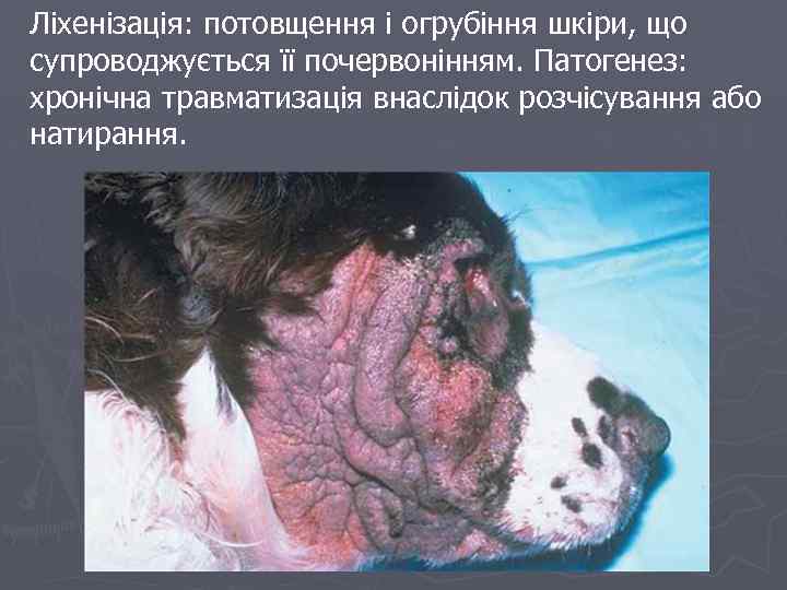 Ліхенізація: потовщення і огрубіння шкіри, що супроводжується її почервонінням. Патогенез: хронічна травматизація внаслідок розчісування