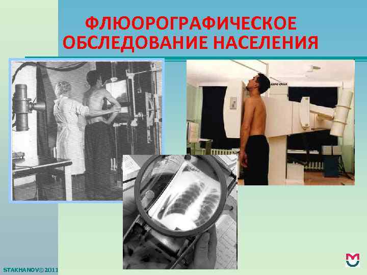 ФЛЮОРОГРАФИЧЕСКОЕ ОБСЛЕДОВАНИЕ НАСЕЛЕНИЯ STAKHANOV© 2011 