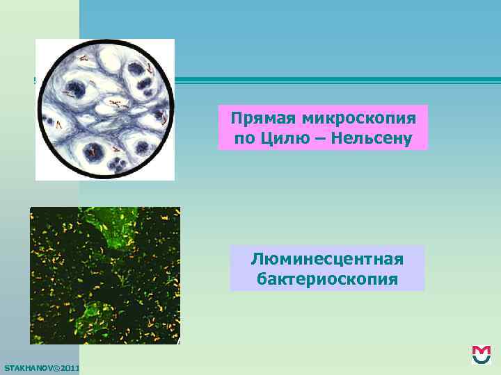 Прямая микроскопия по Цилю – Нельсену Люминесцентная бактериоскопия STAKHANOV© 2011 
