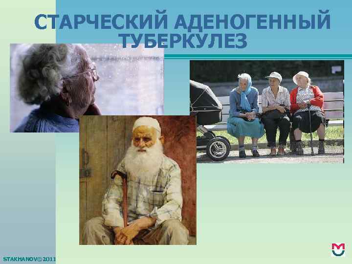 СТАРЧЕСКИЙ АДЕНОГЕННЫЙ ТУБЕРКУЛЕЗ STAKHANOV© 2011 