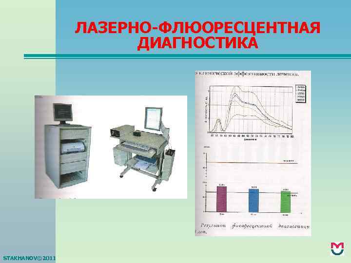 ЛАЗЕРНО-ФЛЮОРЕСЦЕНТНАЯ ДИАГНОСТИКА STAKHANOV© 2011 