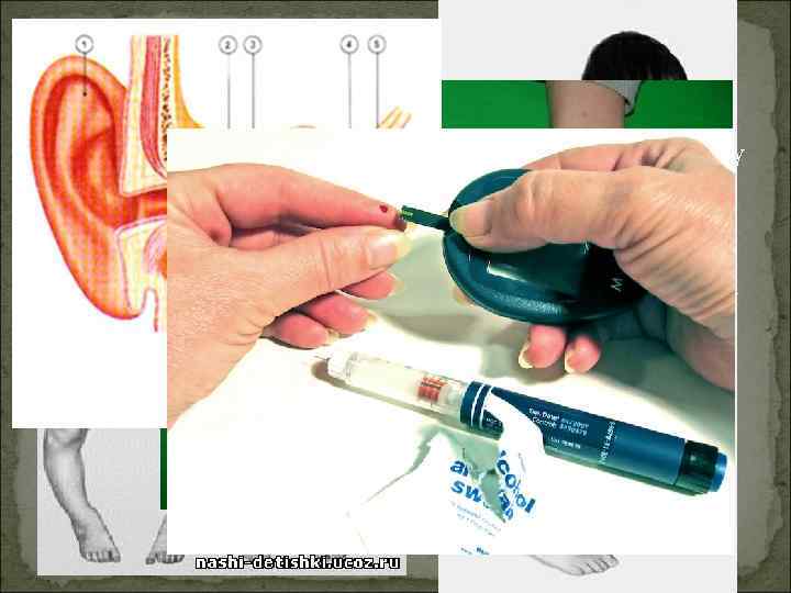  Рахит- дефект доминантного аллеля, вызывающий снижение содержания фосфора в крови. Сахарный диабет –