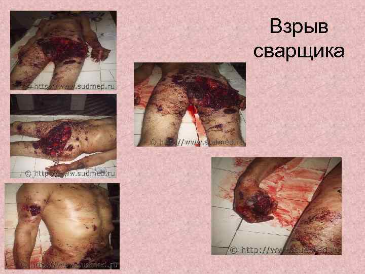 Взрыв сварщика 