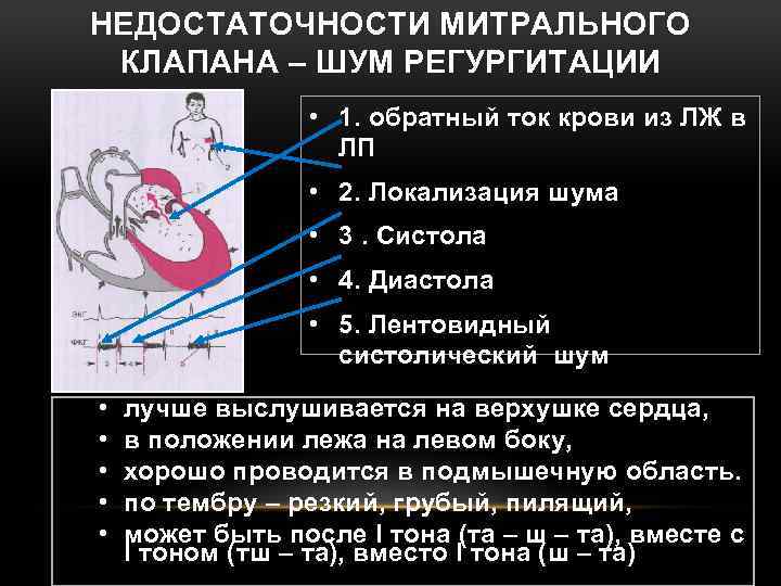 Регургитация митрального клапана 1 степени что это