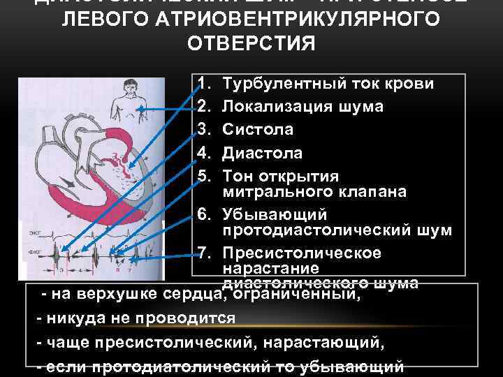 ДИАСТОЛИЧЕСКИЙ ШУМ – ПРИ СТЕНОЗЕ ЛЕВОГО АТРИОВЕНТРИКУЛЯРНОГО ОТВЕРСТИЯ 1. 2. 3. 4. 5. Турбулентный