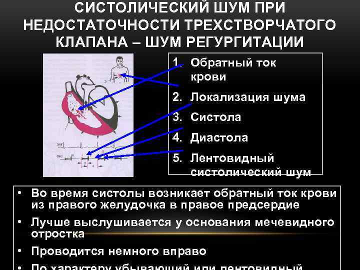 СИСТОЛИЧЕСКИЙ ШУМ ПРИ НЕДОСТАТОЧНОСТИ ТРЕХСТВОРЧАТОГО КЛАПАНА – ШУМ РЕГУРГИТАЦИИ 1. Обратный ток крови 2.