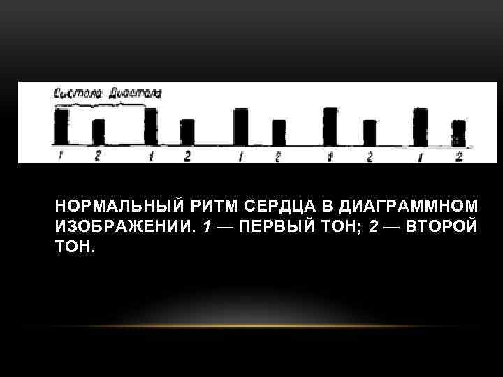 НОРМАЛЬНЫЙ РИТМ СЕРДЦА В ДИАГРАММНОМ ИЗОБРАЖЕНИИ. 1 — ПЕРВЫЙ ТОН; 2 — ВТОРОЙ ТОН.