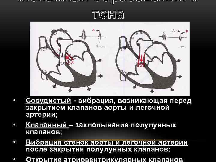 Механизм образования II тона • • Сосудистый - вибрация, возникающая перед закрытием клапанов аорты