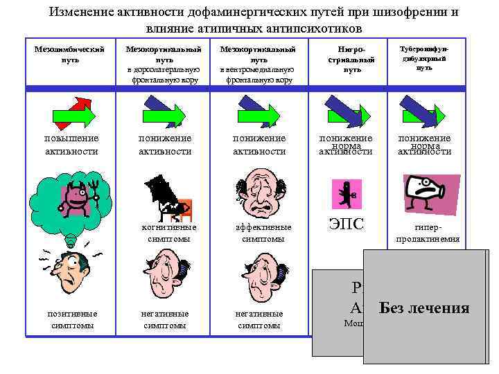 Изменение активности. Мезокортикальный путь при шизофрении.
