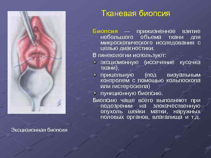 Тканевая биопсия Биопсия — прижизненное взятие небольшого объема ткани для микроскопического исследования с целью
