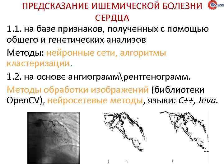 ПРЕДСКАЗАНИЕ ИШЕМИЧЕСКОЙ БОЛЕЗНИ СЕРДЦА 1. 1. на базе признаков, полученных с помощью общего и