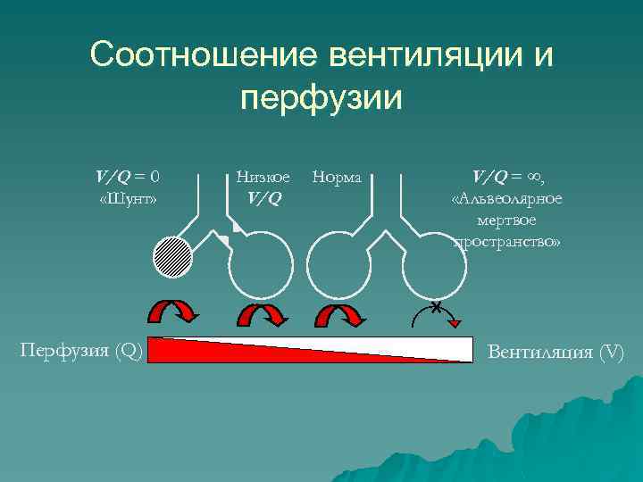 Соотношение вентиляции и перфузии V/Q = 0 Низкое «Шунт» V/Q Перфузия (Q) Норма V/Q