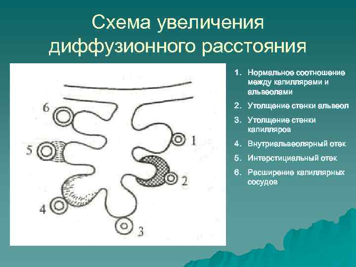 Схема увеличения диффузионного расстояния 1. Нормальное соотношение между капиллярами и альвеолами 2. Утолщение стенки