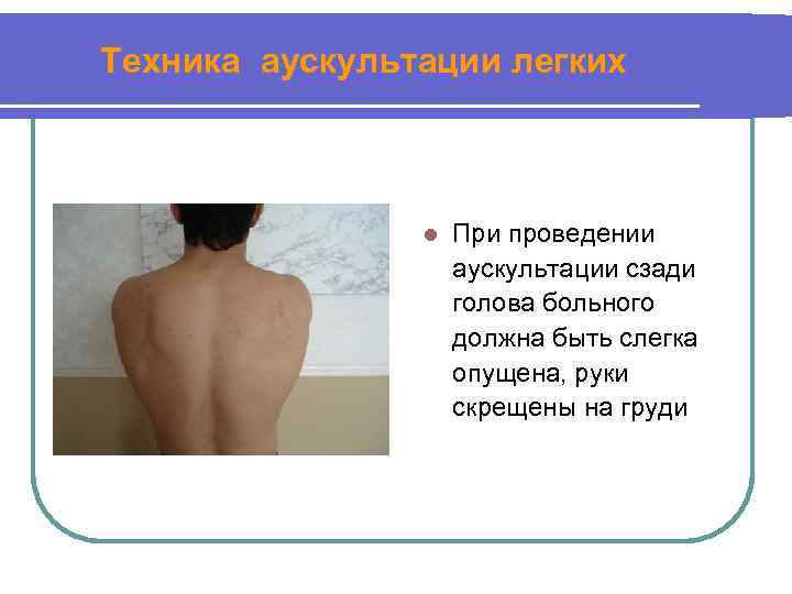 Техника аускультации легких l При проведении аускультации сзади голова больного должна быть слегка опущена,