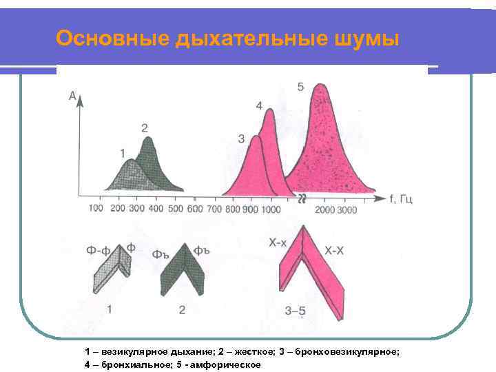 Основные дыхательные шумы 1 – везикулярное дыхание; 2 – жесткое; 3 – бронховезикулярное; 4