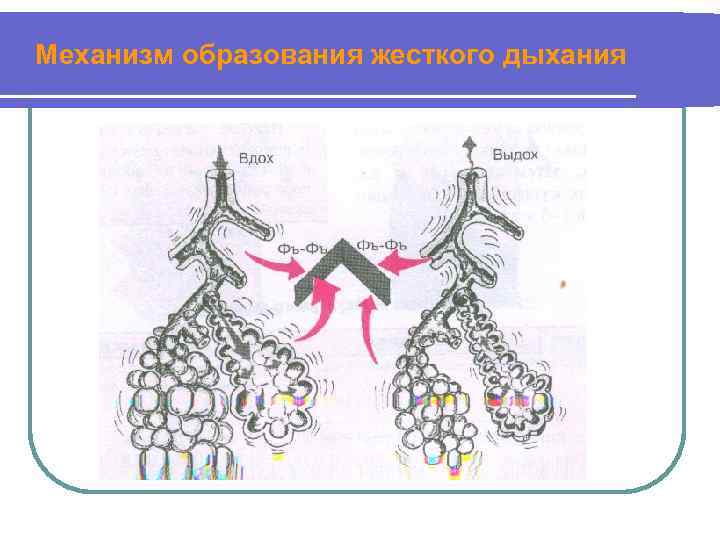 Механизм образования жесткого дыхания 