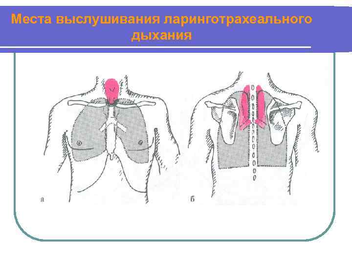 Места выслушивания ларинготрахеального дыхания 