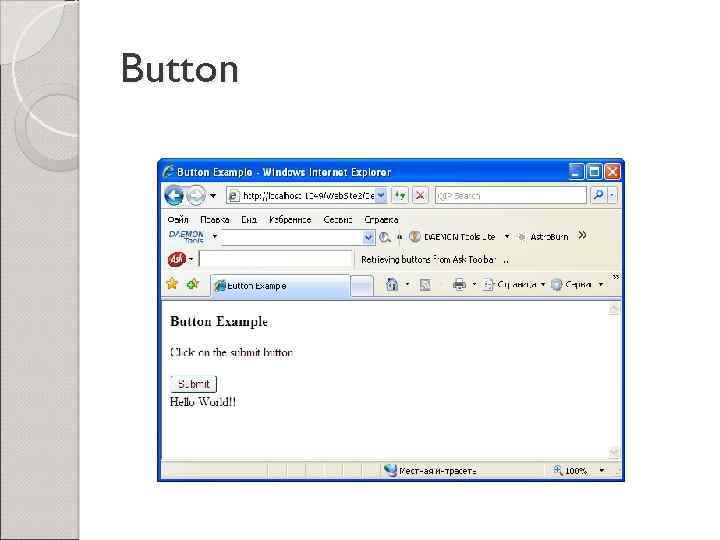 Button 