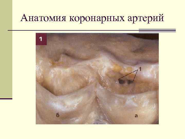 Анатомия коронарных артерий 