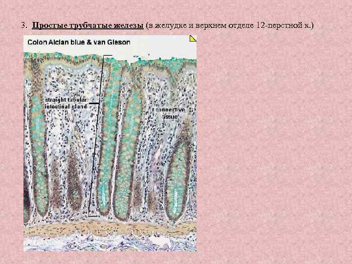 3. Простые трубчатые железы (в желудке и верхнем отделе 12 -перстной к. ) 