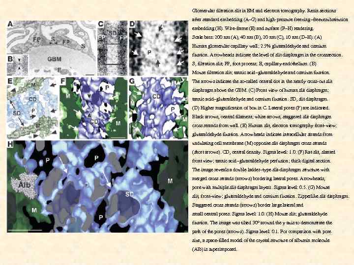 Glomerular filtration slit in EM and electron tomography. Resin sections after standard embedding (A–G)
