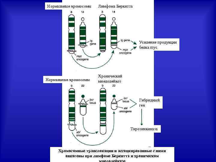 Нормальные хромосомы Лимфома Беркитта Усиление продукции белка myc Нормальные хромосомы Хронический миелолейкоз Гибридный ген