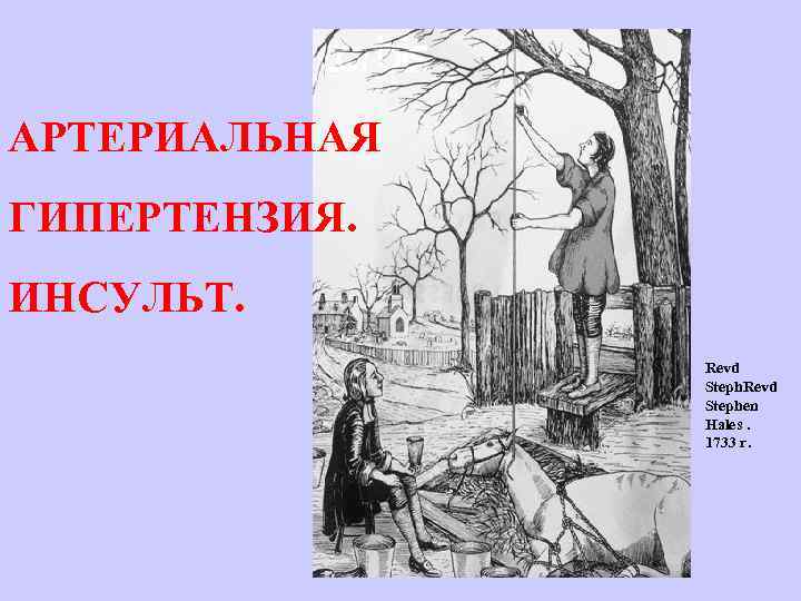 АРТЕРИАЛЬНАЯ ГИПЕРТЕНЗИЯ. ИНСУЛЬТ. Revd Stephen Hales. 1733 г. 