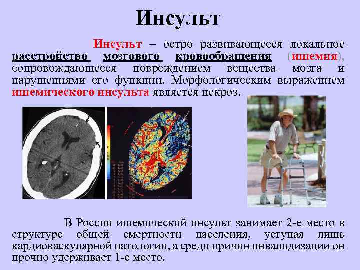 Инсульт қазақша презентация