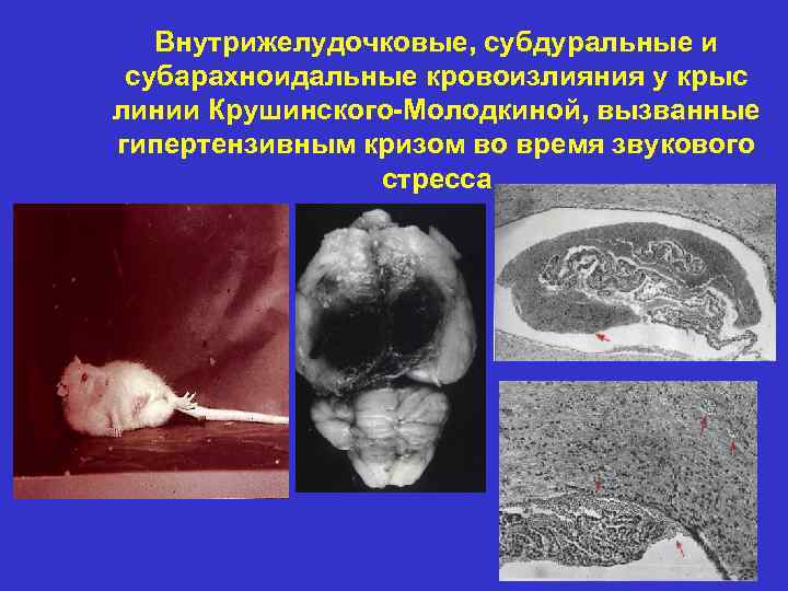 Внутрижелудочковые, субдуральные и субарахноидальные кровоизлияния у крыс линии Крушинского-Молодкиной, вызванные гипертензивным кризом во время