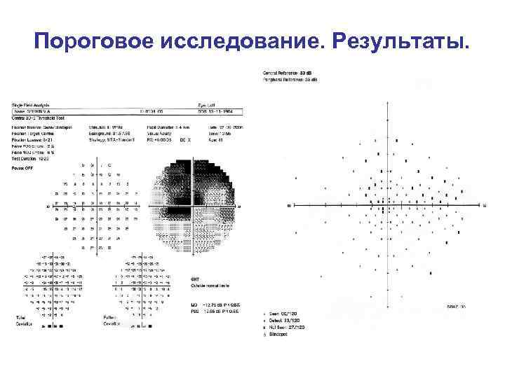 Периметрия расшифровка. Статическая автоматическая периметрия это. Периметрия заключение норма. Поля зрения расшифровка компьютерной периметрии. Периметрия статическая расшифровка.