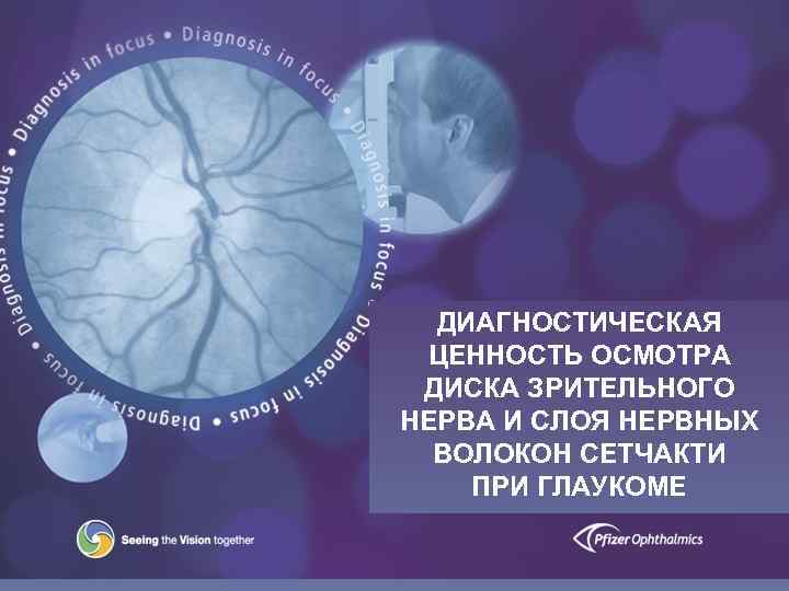 ДИАГНОСТИЧЕСКАЯ ЦЕННОСТЬ ОСМОТРА Focus Programme ДИСКА ЗРИТЕЛЬНОГО НЕРВА И СЛОЯ НЕРВНЫХ ВОЛОКОН СЕТЧАКТИ ПРИ